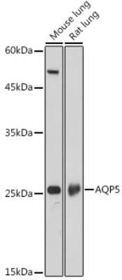 Western Blot: Aquaporin-5 Antibody [NBP3-02963] - Western blot analysis of extracts of various cell lines, using Aquaporin-5 antibody (NBP3-02963) at 1:1000 dilution. Secondary antibody: HRP Goat Anti-Rabbit IgG (H+L) at 1:10000 dilution. Lysates/proteins: 25ug per lane. Blocking buffer: 3% nonfat dry milk in TBST. Detection: ECL Basic Kit. Exposure time: 10s.